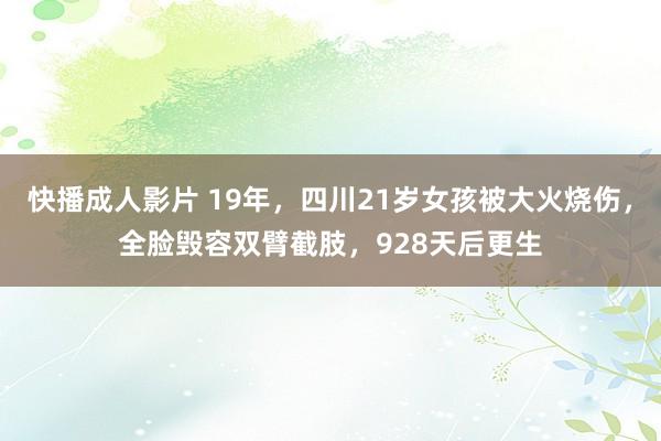 快播成人影片 19年，四川21岁女孩被大火烧伤，全脸毁容双臂截肢，928天后更生